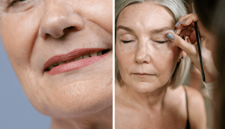 Dermal Fillers in Lucknow